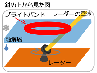 ブライトバンド